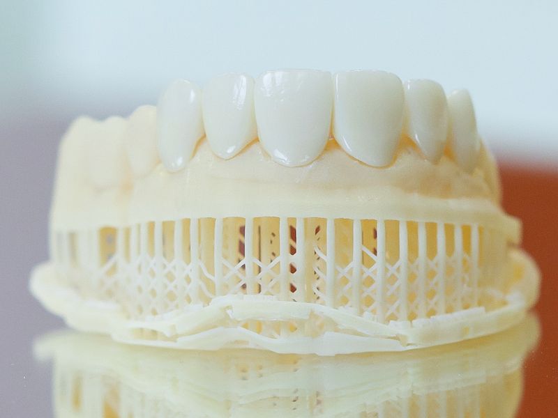 Veneers